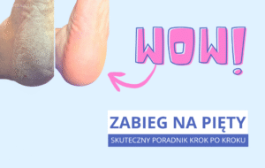 Otopodolog | Zabieg na pięty